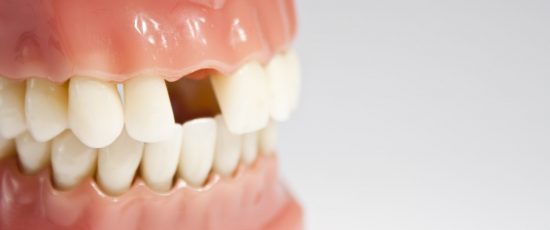 La perte des dents est-elle inévitable avec l’âge ?